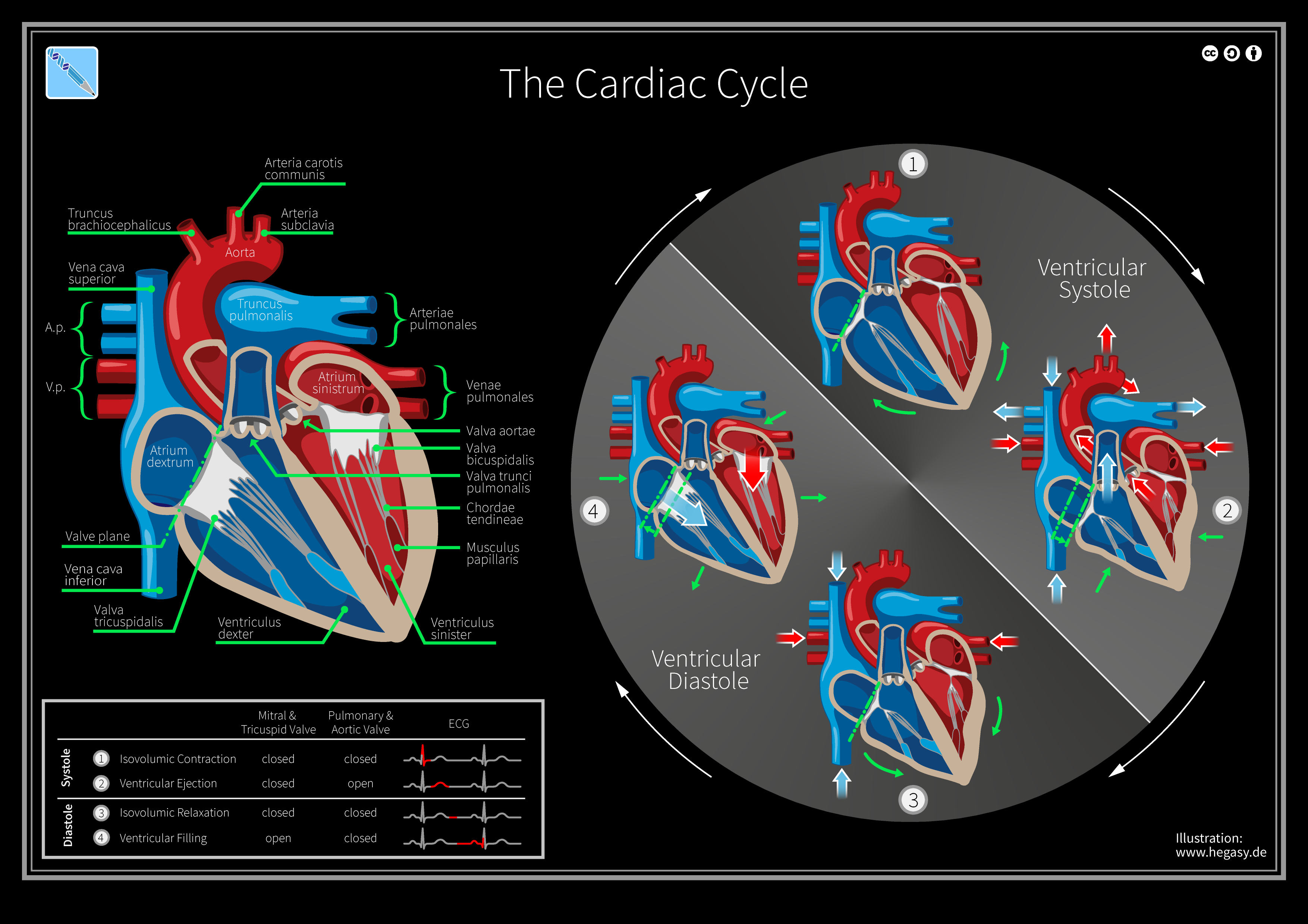 Diagram of the cardiac cycle showing systole and diastole phases with pressure and volume changes