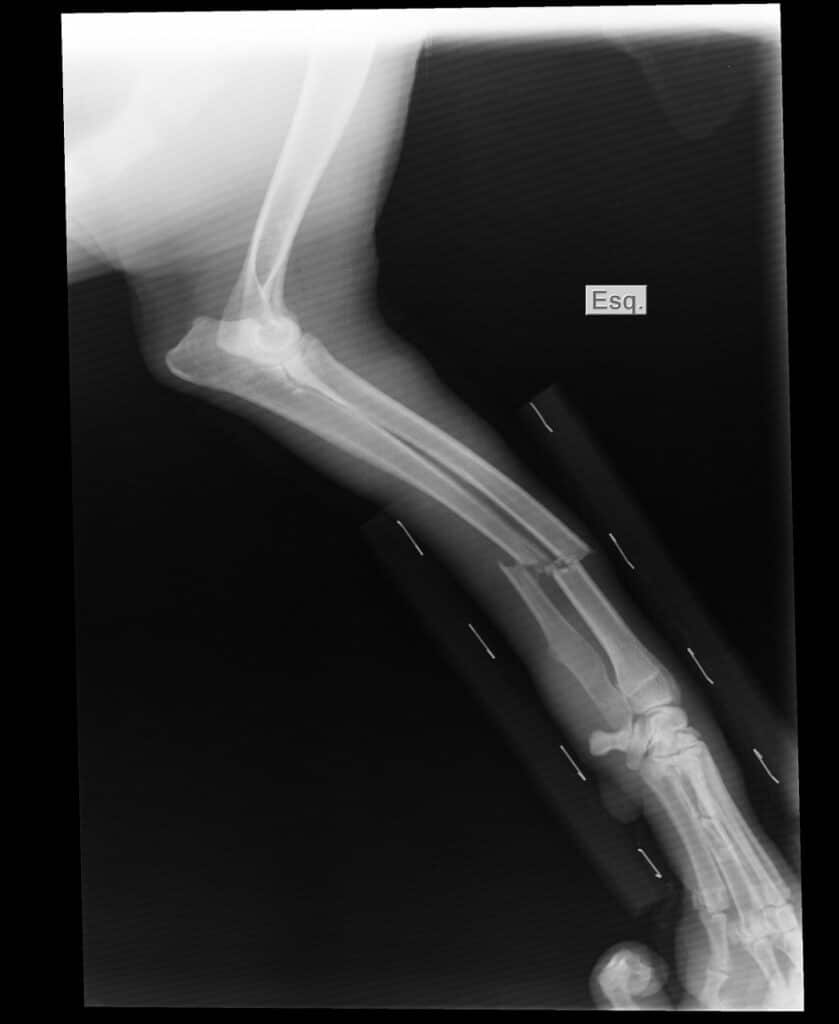 Deformity — broken arm requiring EMT assessment